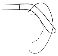 耳介の付け根の形状1