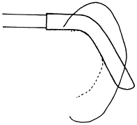 耳介の付け根の形状2