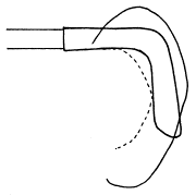 耳介の付け根の形状3