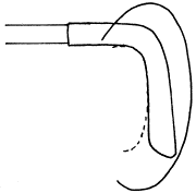 耳介の付け根の形状6